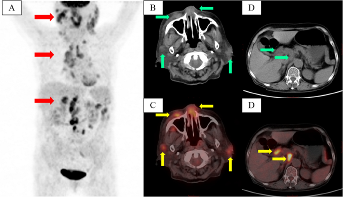 PET-CT in China