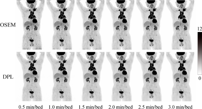 PET-CT results in China for foreign patients